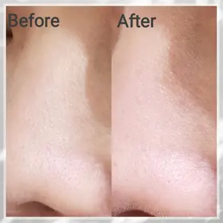 小顔・ツルツル素肌 ハリステリアのエステ・リラクイメージ