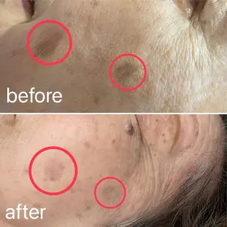 痛くないシミ取り 【荻窪】石橋のヘアスタイル