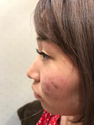 マツエク・マツパ 佐藤 悠里のネイルデザイン