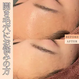 憧れ韓流素肌に🪽 毛穴肌管理のエステ・リラクイメージ