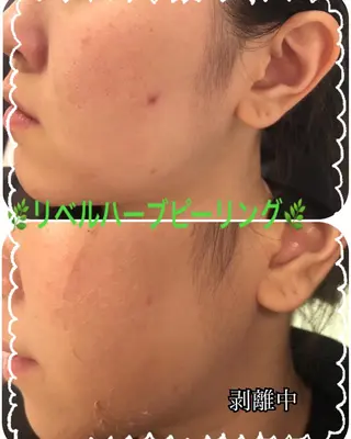 Dione八王子店所属・LUKE （ルーク）のエステ・リラクイメージ