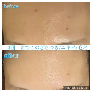 ロング カラー パーマ ヘアアレンジ メンズ キッズ ネイル マツエク・マツパ Ensor Clair所属・EnsorClair 代表 野口真央のエステ・リラクイメージ