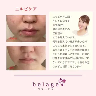 ベラージュ【美背中・ 美尻・フェイシャル】のエステ・リラクイメージ