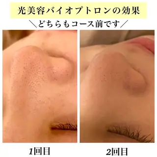 Bellesthe (ベルエステ)のエステ・リラクイメージ