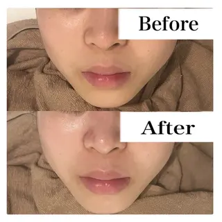 ハーブピーリング LIME池袋東口のエステ・リラクイメージ