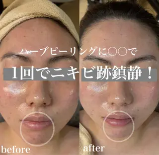 WHITE AQUA 北千住店のエステ・リラクイメージ