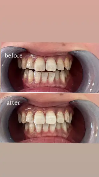 セルフホワイトニング Shineeのエステ・リラクイメージ