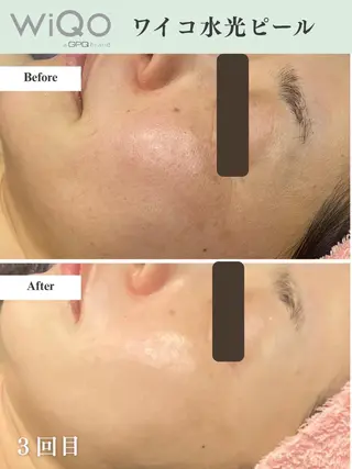 脱毛・眉毛・フェイス サロンN久留米店のその他イメージ