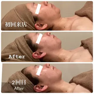 Ｂ&H所属・頭痛•肩こり専門/ 眉サロンB&H心斎橋のエステ・リラクイメージ