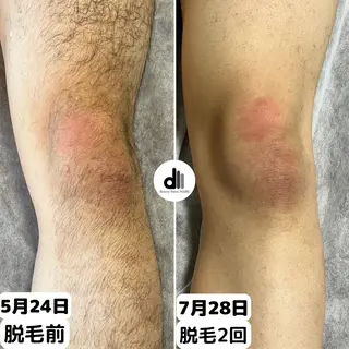 メンズ Beauty Salon MARU所属・新潟市メンズ【脱毛】 MARUのエステ・リラクイメージ
