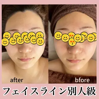 ■超絶小顔&肌管理室■所属・🦋整形級の究極美顔 本格韓国式小顔🦋のエステ・リラクイメージ