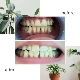 脱毛専門サロンELIXIR（ｴﾘｸｻｰ）所属・脱毛&ホワイトニング ELIXIR×ULTのエステ・リラクイメージ