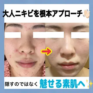 Wita   aesthetic×eyelash所属・上坂 祐以のエステ・リラクイメージ