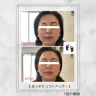 Bijou+幸手店所属・ビジュープラス幸手 由美のエステ・リラクイメージ