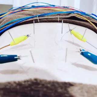 Spring鍼灸院所属・Spring鍼灸院 ✨首肩こり、腰痛に!のエステ・リラクイメージ