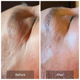 Mandarin Orange所属・毛穴から始める肌メン テマンダリンオレンジのエステ・リラクイメージ