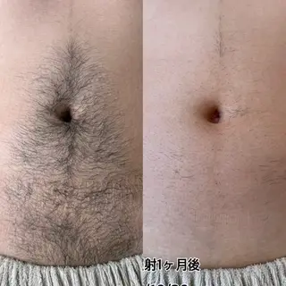 メンズ salon il 【眉毛・脱毛】の眉毛・アイブロウイメージ