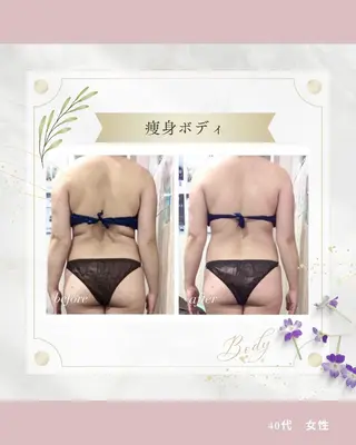 痩身専門エステ addissimoのエステ・リラクイメージ