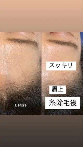 産毛専門店 Bittoのエステ・リラクイメージ