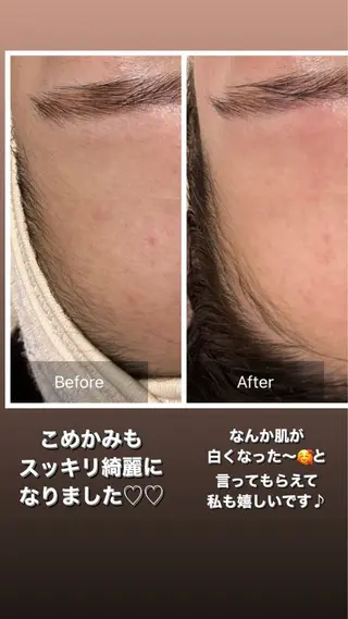 産毛専門店 Bittoのエステ・リラクイメージ