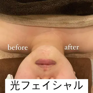 Rene 慢性疲労ケアサロンのエステ・リラクイメージ