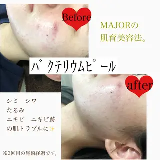 美肌脱毛と癒しのプライベートサロン。gratia~グレイティア~所属・gratia ~グレイティア~のエステ・リラクイメージ