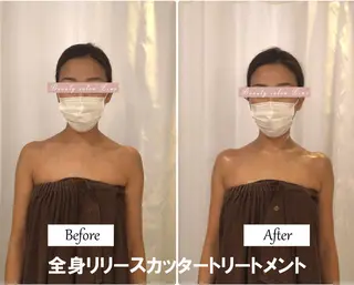 痩身×フェイシャル ブライダル|Linoのエステ・リラクイメージ