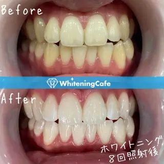 ホワイトニングカフェ神戸元町店所属・ホワイトニングカフェ 神戸元町店のエステ・リラクイメージ