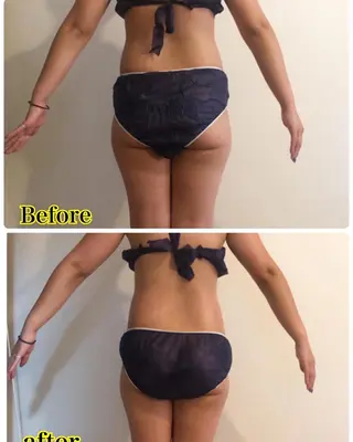 ❤︎MN❤︎ モンのエステ・リラクイメージ