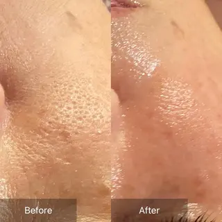 Mandarin Orange所属・毛穴から始める肌メン テマンダリンオレンジのエステ・リラクイメージ