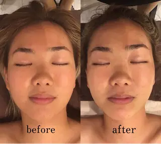 痩身×フェイシャル ブライダル|Linoのエステ・リラクイメージ