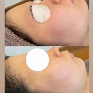 cocoha所属・フェイシャルサロン cocohaのエステ・リラクイメージ