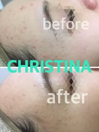 肌質改善サロンChouChou所属・肌質改善サロン chouchouのエステ・リラクイメージ