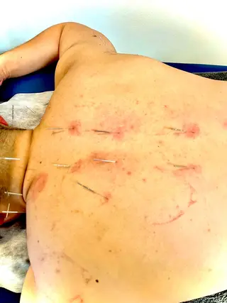 【鍼灸サロン にった】所属・はりきゅう整体 新田鍼灸院のエステ・リラクイメージ