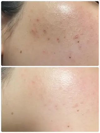 メナード片町 やまもと みくのエステ・リラクイメージ