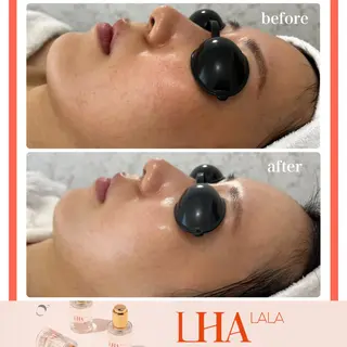 Liam《美肌管理/ 3D小顔/脂肪ケア》のその他イメージ