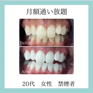 メンズ ホワイトニング専門店 WHITE天神店のエステ・リラクイメージ