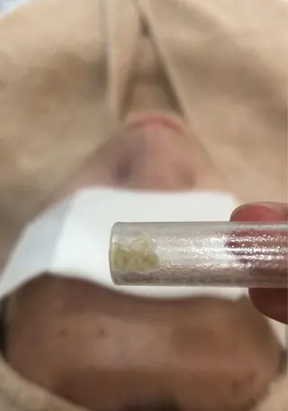 Angela エステサロンのマツエク・マツパデザイン