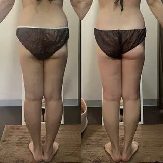 ハイパーナイフ専門店 Salon de COCO所属・Salon de COCOのエステ・リラクイメージ