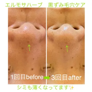 オーガニック＆ホロソフィー　エステサロンGARDEN所属・GARDEN 田辺加代子のエステ・リラクイメージ