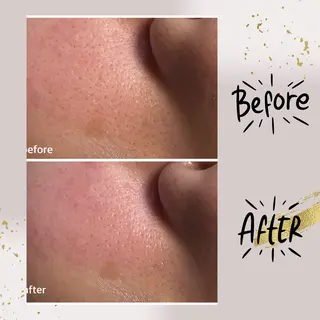 ピーリング専門店 Belluteのエステ・リラクイメージ