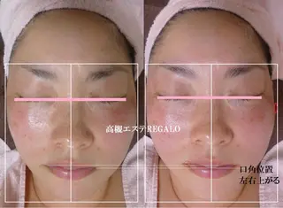 REGALO所属・矢野 さやかのエステ・リラクイメージ