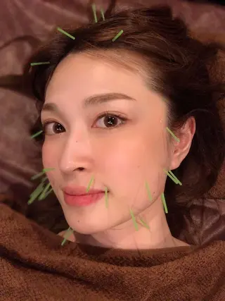 メンズ 美容鍼灸サロン LOMIHARIのエステ・リラクイメージ