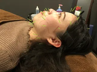 メンズ 美容鍼灸サロン LOMIHARIのエステ・リラクイメージ