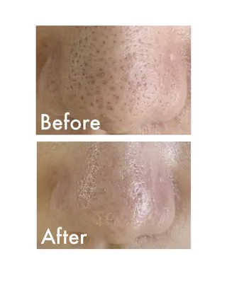 Soin＋ みきのエステ・リラクイメージ