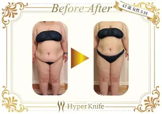 所沢痩身小顔コルギ AromaQueenのエステ・リラクイメージ