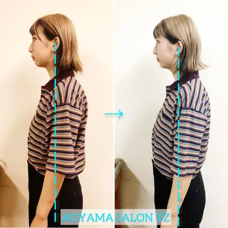 小顔美容鍼専門サロン 渋谷YZのエステ・リラクイメージ