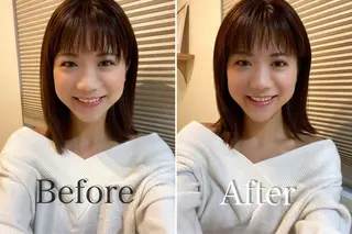 鍼灸整骨院Refine所属・鍼灸 Refineのその他イメージ