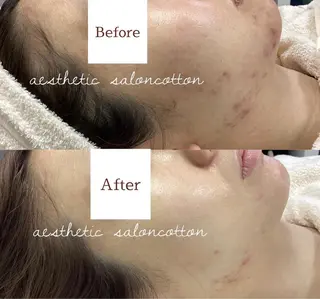 都度払い 肌質改善専門サロンのエステ・リラクイメージ