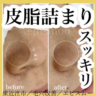 epismoo 脱毛/HBL/毛穴の眉毛・アイブロウイメージ